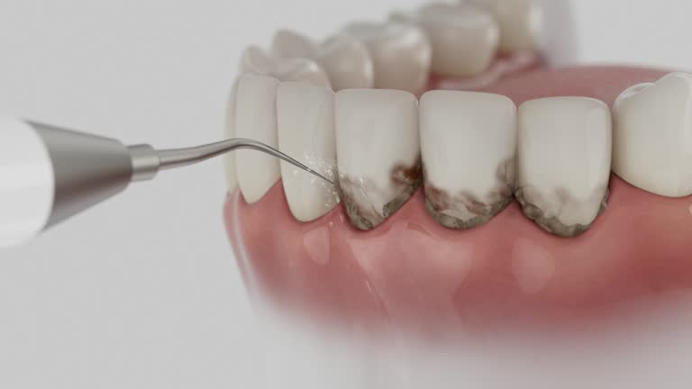Trusted Teeth Cleaning And Checkup service in Sedgwick, KS - Dentist Open Now